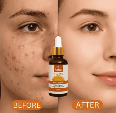 Relax Vitamin C Serum. Buy 1 Get 2 Free.